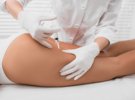 CELLULITE